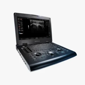 Versana Active ecógrafo