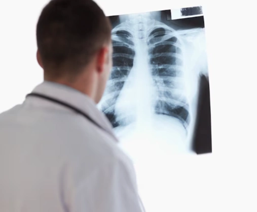 image-ray-x-poratiles-4d-medicine-3
